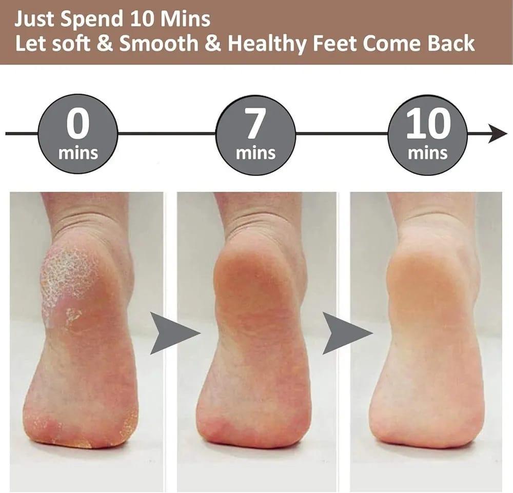 Rechargeable Electric Foot Filer – Dead Skin & Callus Remover | Bachat Hub
