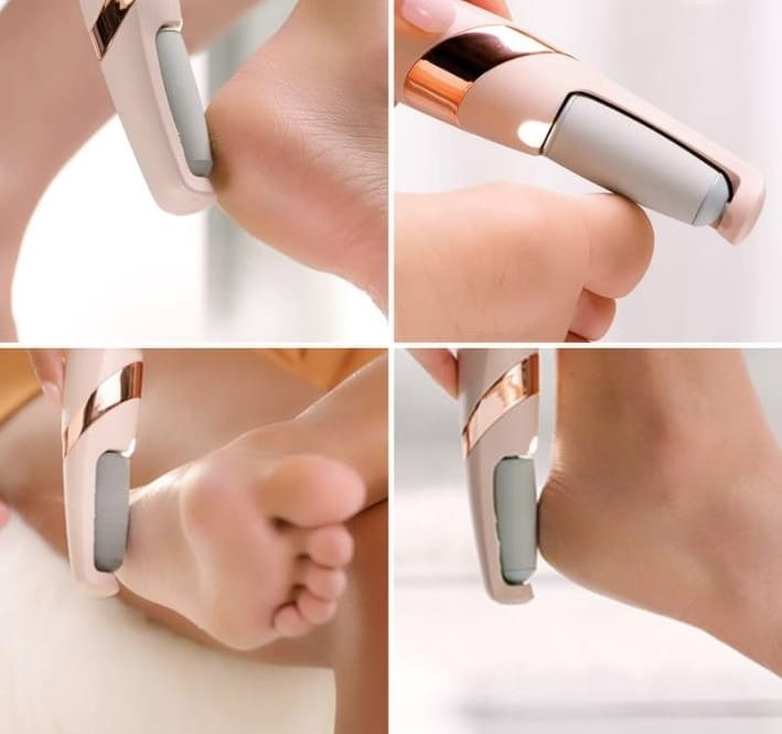 Rechargeable Electric Foot Filer – Dead Skin & Callus Remover | Bachat Hub